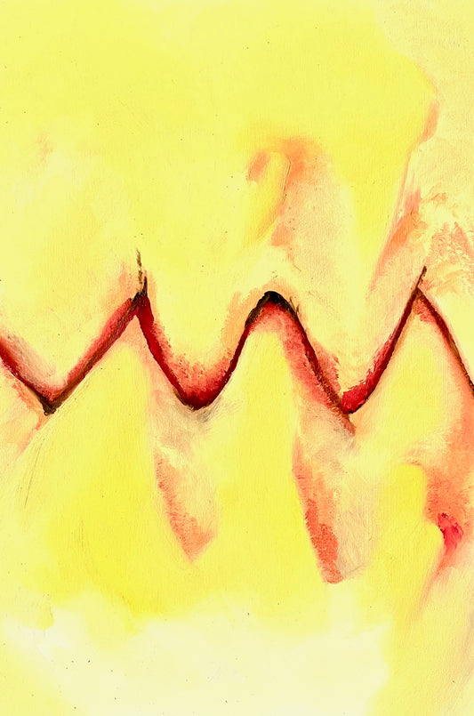 MM